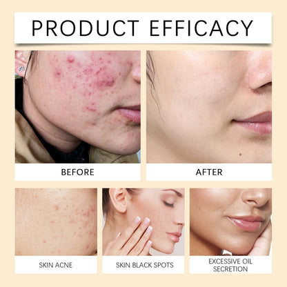 HerBalance Glow Pads-Brightening Turmeric & Kojic Acid Pads